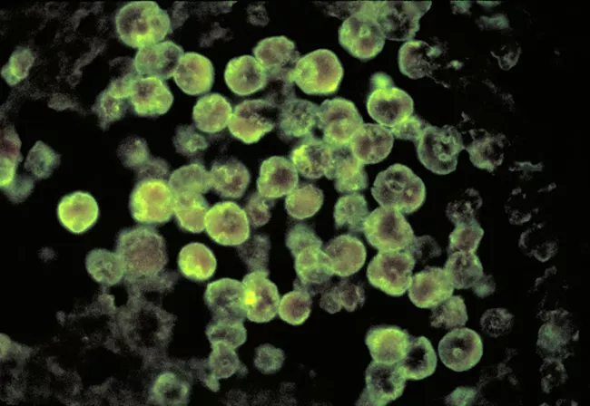 Brain-Eating Amoeba Wins Again In Louisiana Lake Tragedy