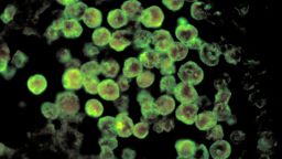 Brain-Eating Amoeba Wins Again In Louisiana Lake Tragedy