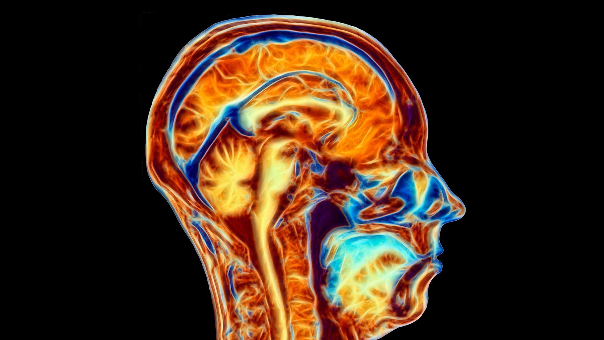 Diagram Of A Patriot’s Brain